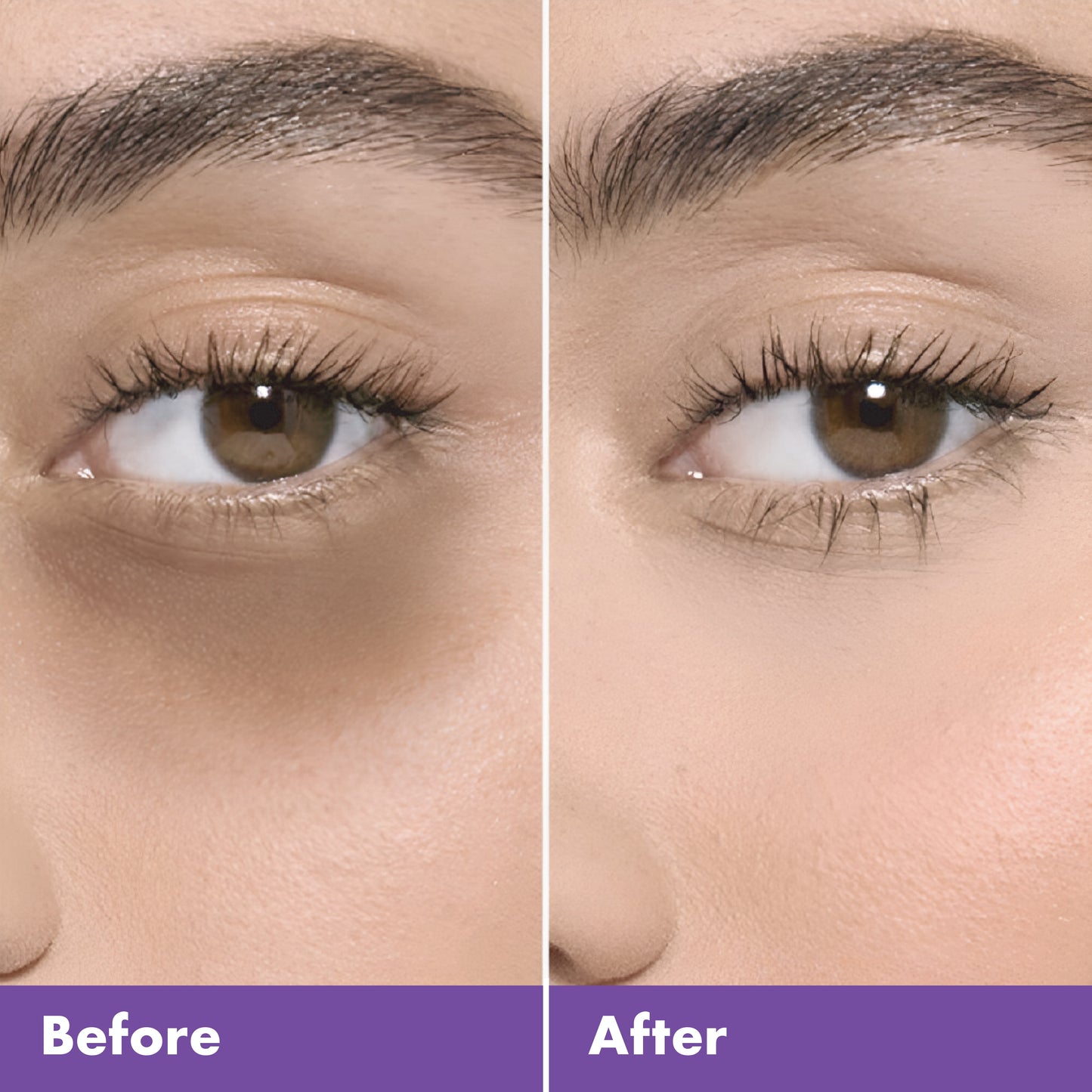 Under Eye Gel | With Lactic Acid, Peptides, Quinoa Seed & Shea Butter | Reduces Dark Circles, Puffiness & Fine Lines